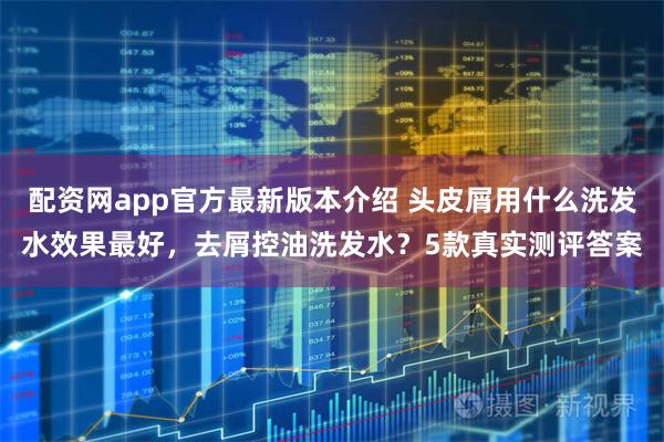 配资网app官方最新版本介绍 头皮屑用什么洗发水效果最好，去屑控油洗发水？5款真实测评答案